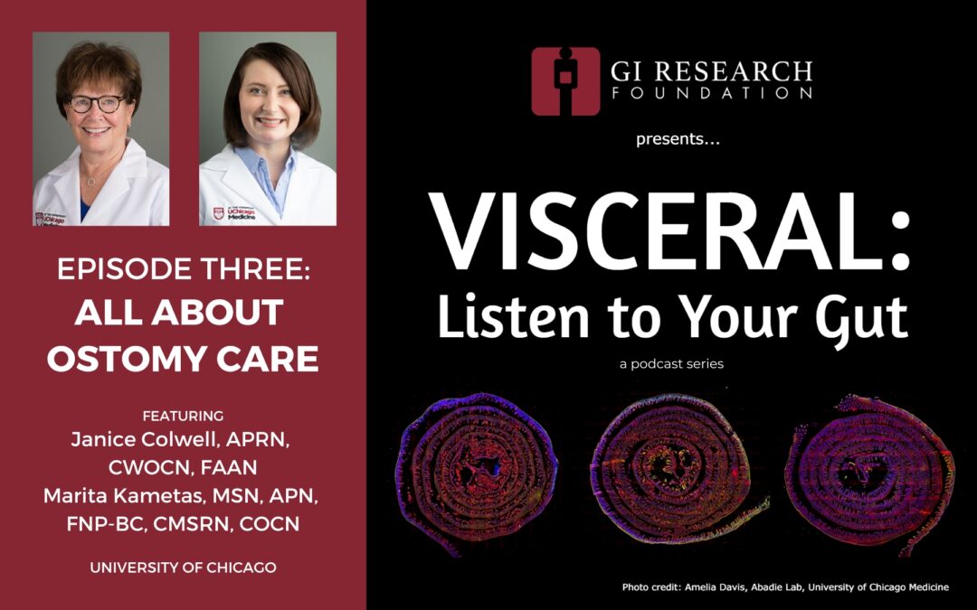 Visceral: Podcast Episode Three – All about Ostomy Care