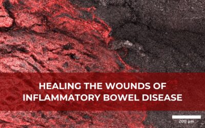 Healing the Wounds of Inflammatory Bowel Disease