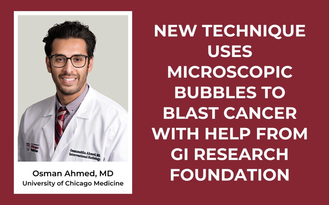 New Technique Uses Microscopic Bubbles to Blast Cancer With Help From GI Research Foundation